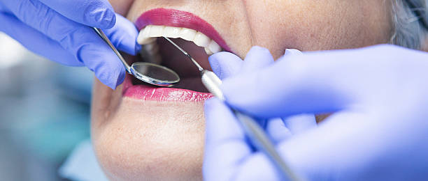 Best After-Hours Emergency Dentist in Vero Lake Estates, FL
